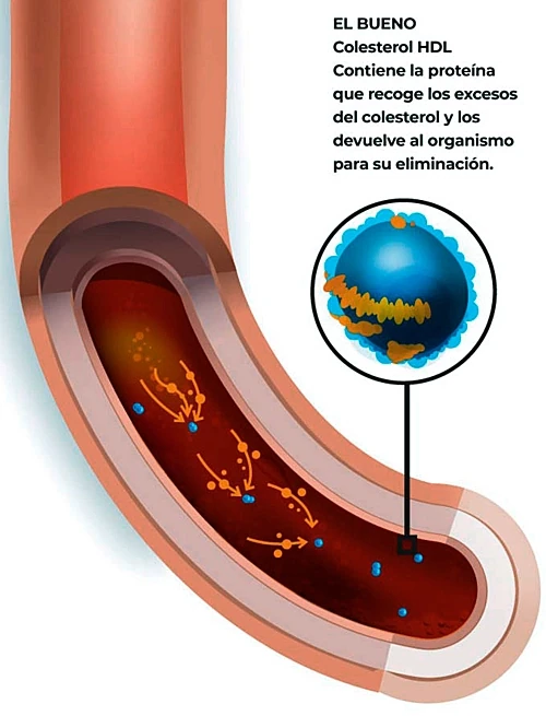 Ilustración de una porción de una vena humana, ampliada, mostrando los peligros del colesterol HDL. www.duduromeroa.com, Guayaquil, Ecuador
